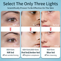 Flexible silicone LED light therapy facial skincare mask — view 5
